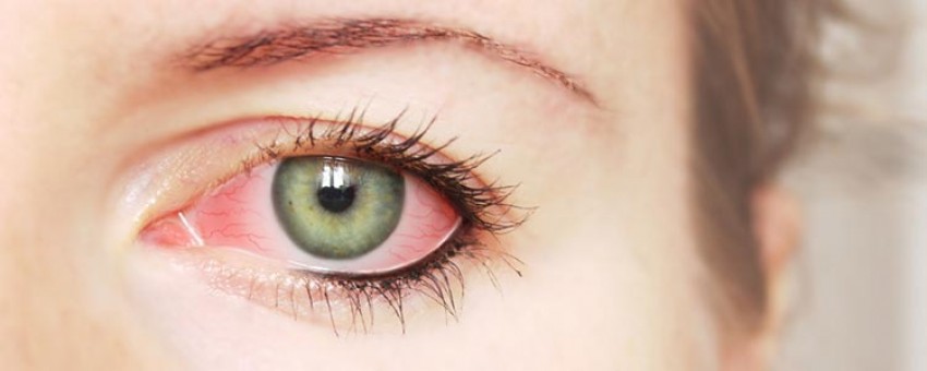 بیمار‌های چشمی و مکملهای بینایی را بشناسیم