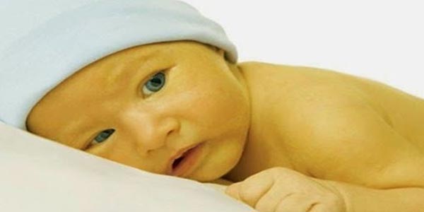 تشخیص و درمان زردی در نوزاد