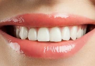 افزایش اعتماد به نفس با دندان های زیبا