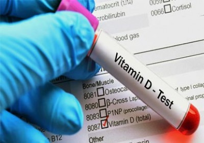 بیماری MS به کمبود ویتامین D مربوط است؟