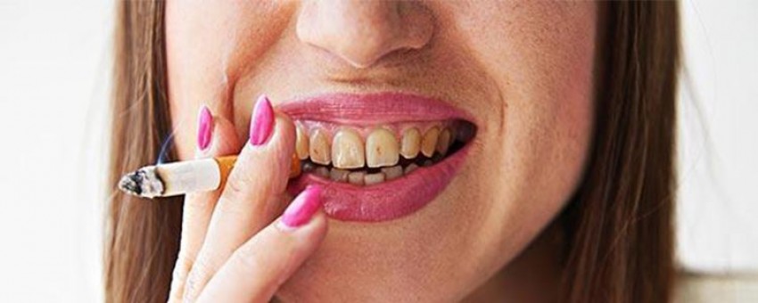 داشتن دندان های سالم در دوران مصرف سیگار