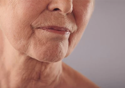 چگونه از پیری پوست جلوگیری کنیم؟