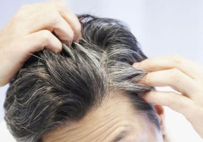 چگونه از سفید شدن مو جلوگیری کنیم؟