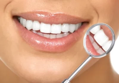 انواع محصولات سفید کننده دندان + علت زردی آن