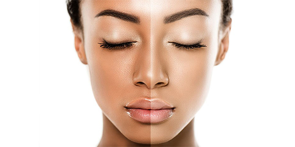 معرفی 6 کرم روشن کننده برای پوست‌های تیره