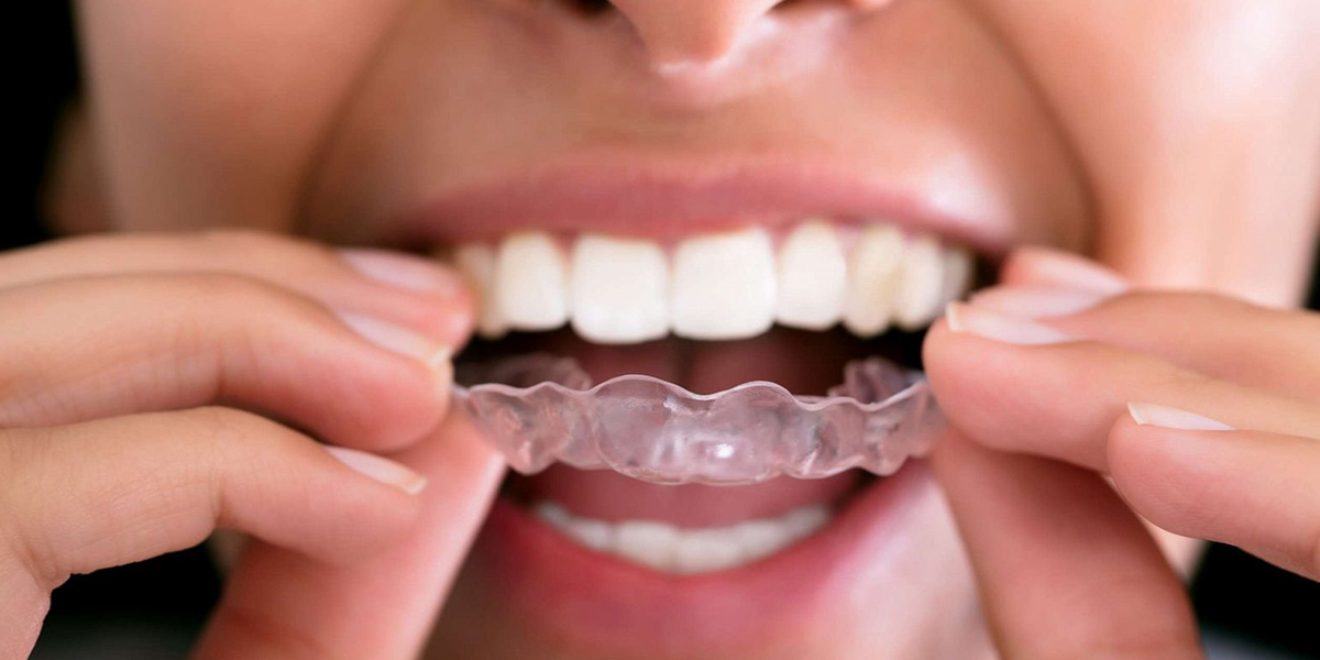 چگونه از دندان قروچه پیشگیری کنیم؟