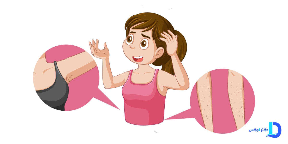 علل اصلی ایجاد پوست مرغی چیست؟