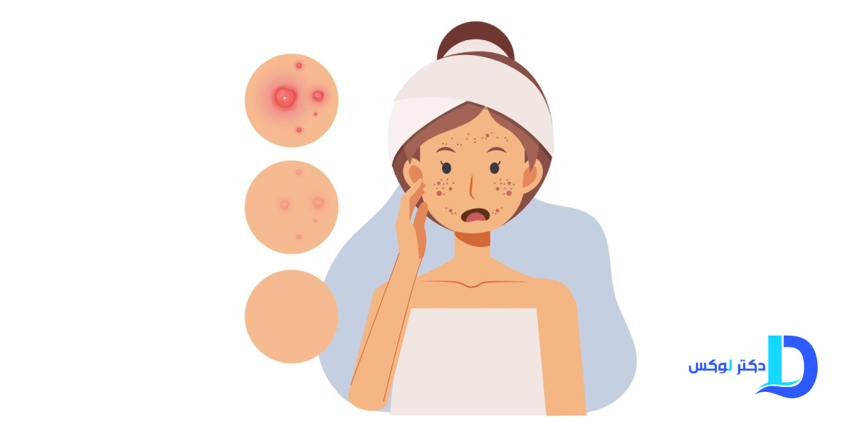 چه زمانی باید به متخصص پوست مراجعه کنیم؟
